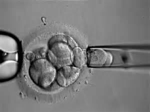 PGD、PGS、NIPT傻傻分不清楚？一文读懂！